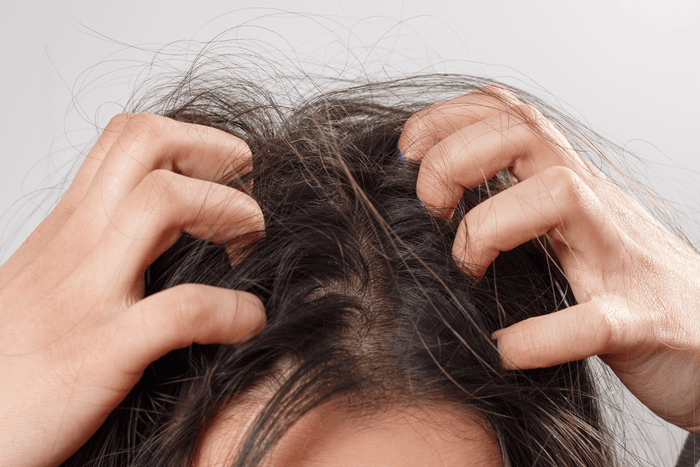 FFOR Hair best shampoo for a dry scalp image